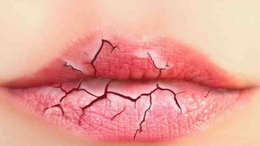 Care for your lips